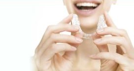 Clear braces